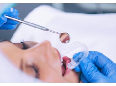 Пломби фотополімерні та склоіономерні